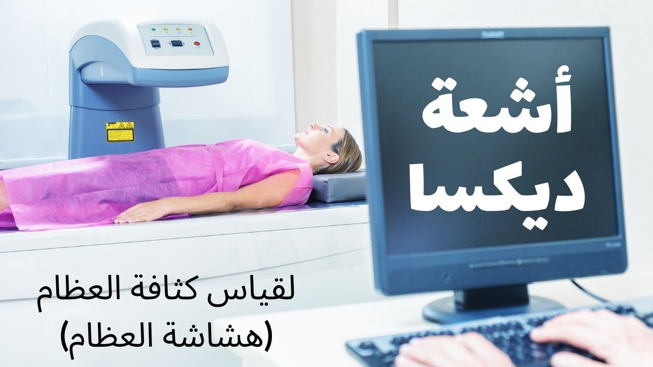 اشعة هشاشة العظام​