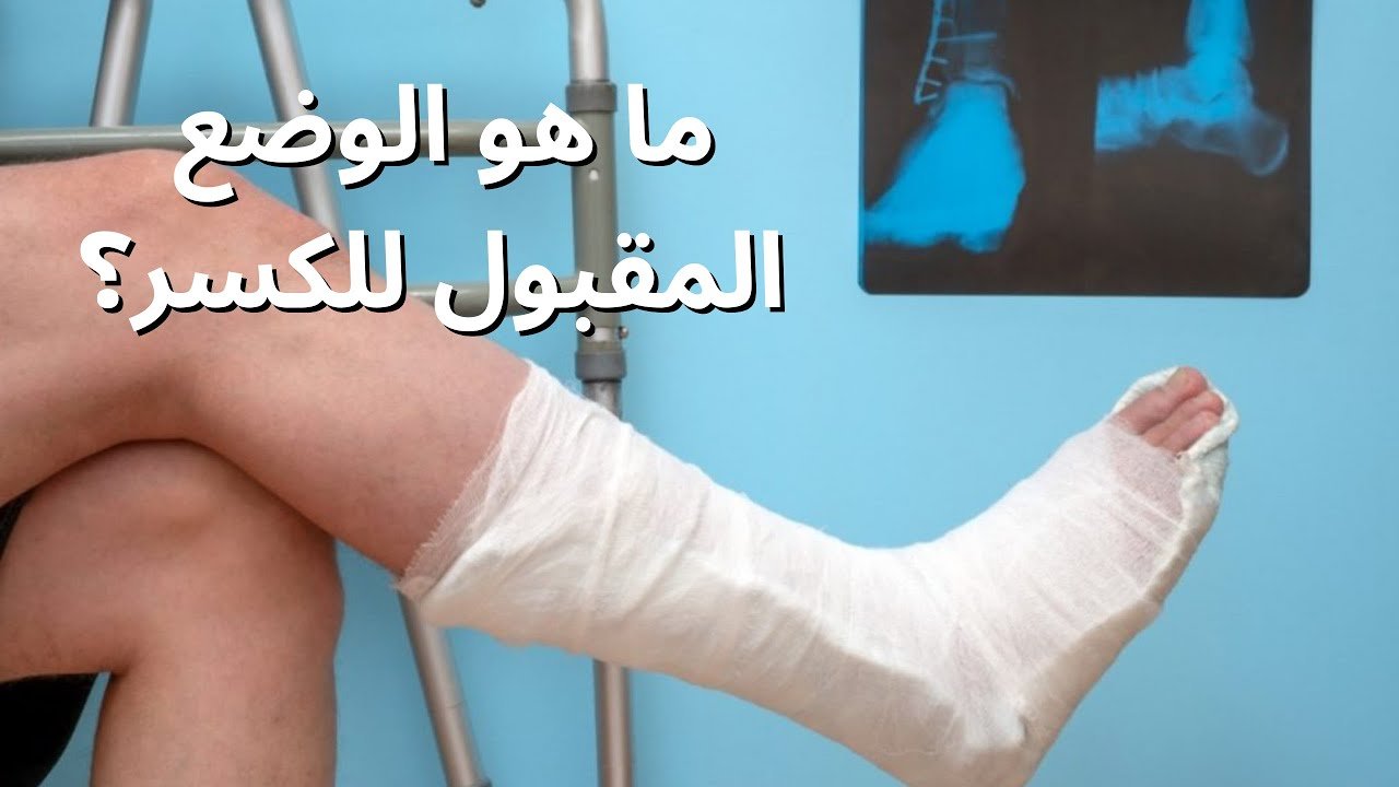 التئام العظام بعد الكسر