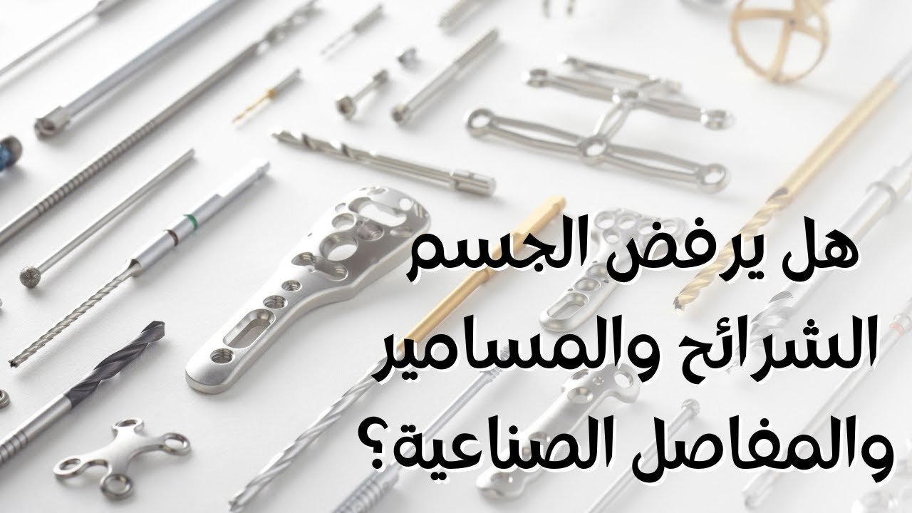 اسباب التورم بعد تركيب الشرائح المسامير