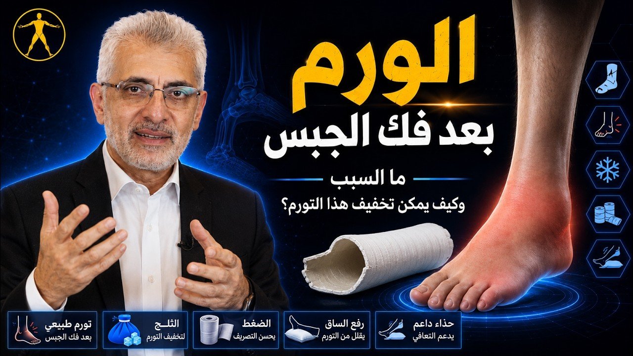 ورم بعد فك الجبس