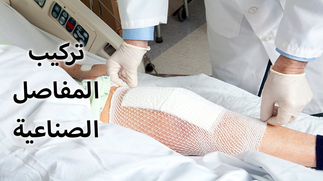 عملية تغير مفصل بنجاح مع د. هشام عبد الباقي