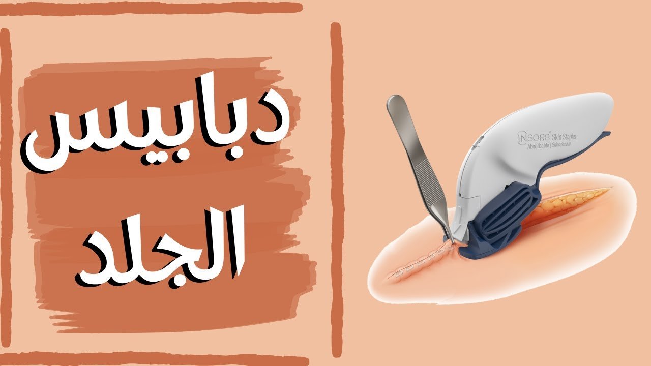دبابيس الجلد الجراحيه​
