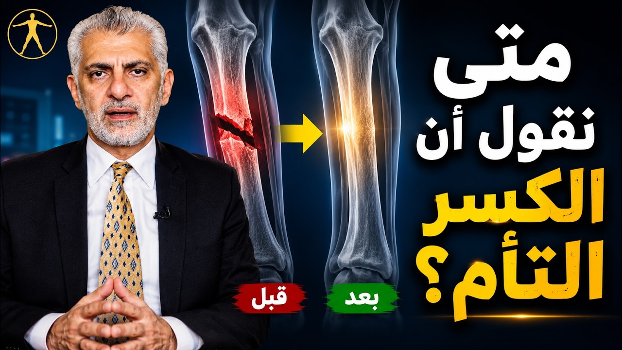 الدكتور هشام عبد الباقي يشرح علامات التئام الكسور