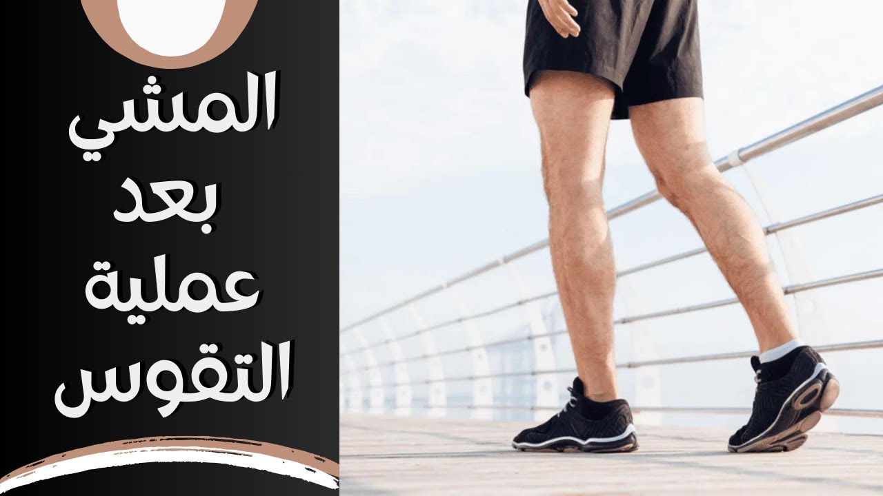 المشي بعد عملية استعدال تقوس الساقين: متى؟