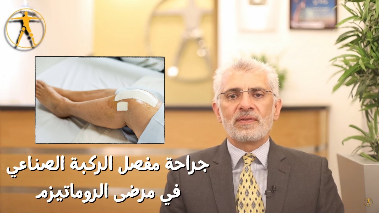 الدكتور هشام عبد الباقي يشرح تركيب مفصل ركبة صناعي في مرضى الروماتيزم