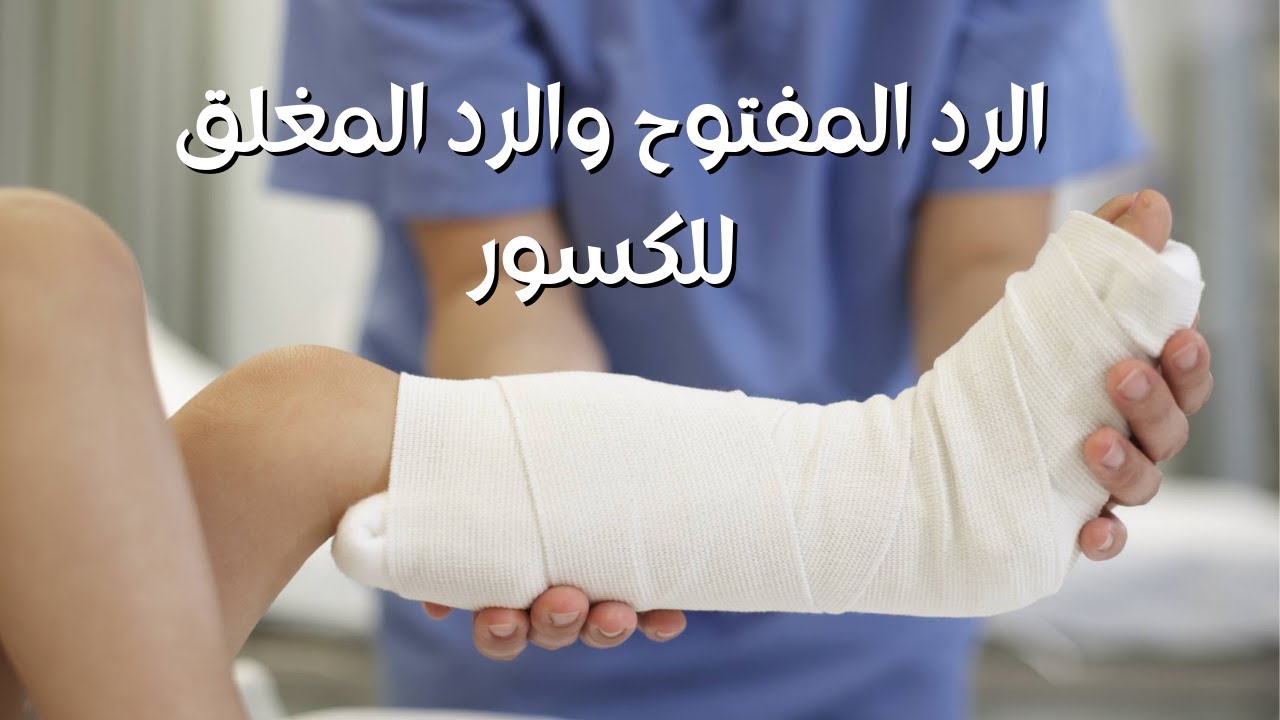 الدكتور هشام عبد الباقي يشرح الفرق بين رد الكسر المفتوح والمغلق