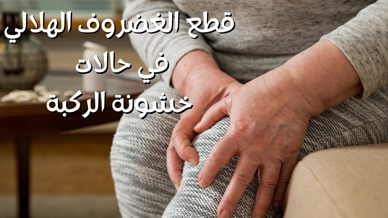 الدكتور هشام عبد الباقي يشرح قطع الغضروف الهلالي في حالات خشونة الركبة