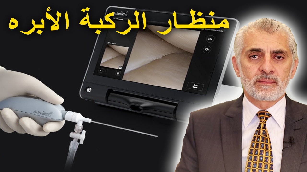 الدكتور هشام عبد الباقي يشرح منظار الركبة بالإبرة