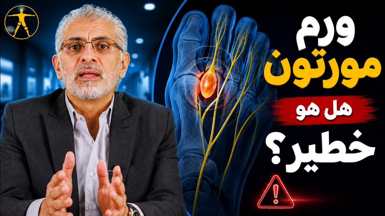 الدكتور هشام عبد الباقي يشرح ورم مورتون العصبي